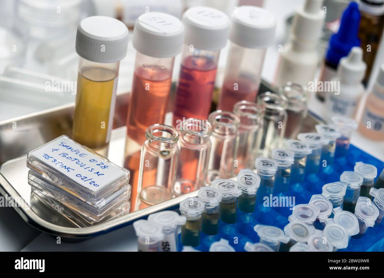 Samples contaminated by Clostridium botulinum toxin that causes botulism in humans, laboratory research, conceptual image Stock Photo