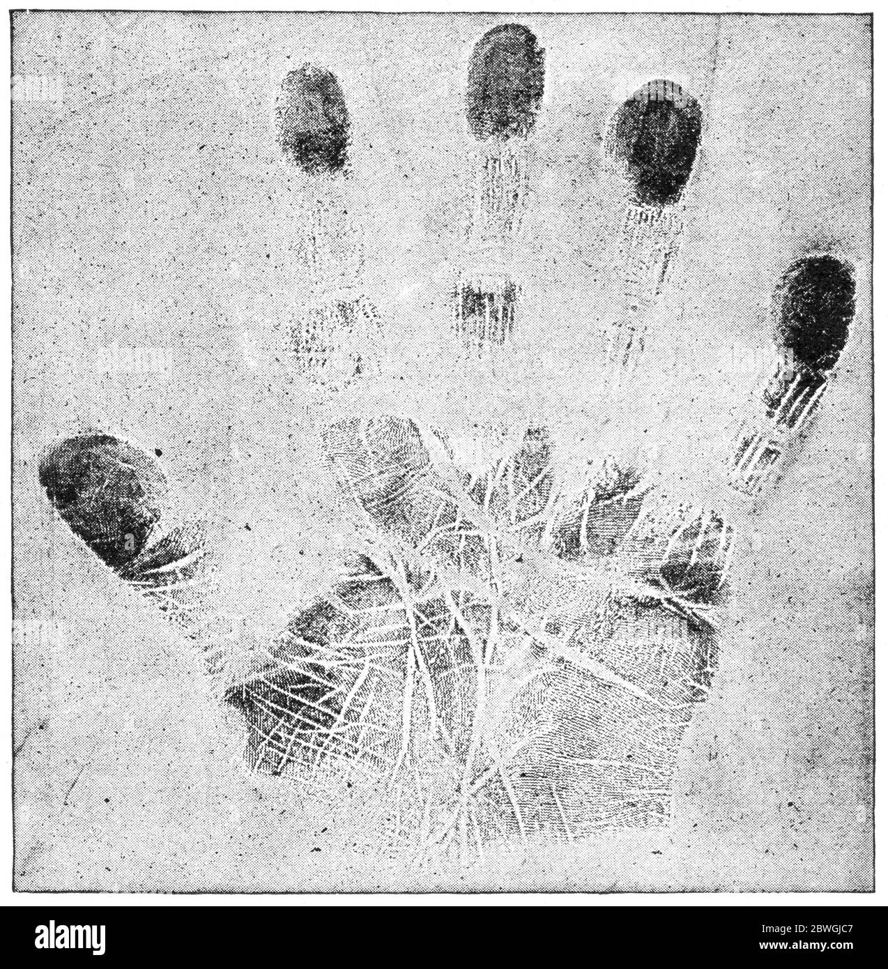 Fingerprints are one of the women's child-killers (1898). Illustration of the 19th century. White background. Stock Photo