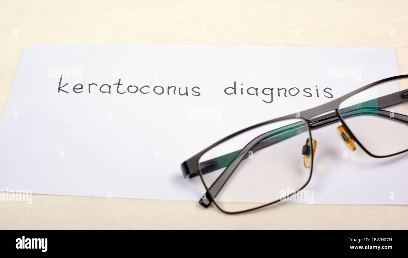 glasses for vision and the inscription diagnosis keratoconus on the table close-up. eye disease, diagnosis and treatment. Stock Photo