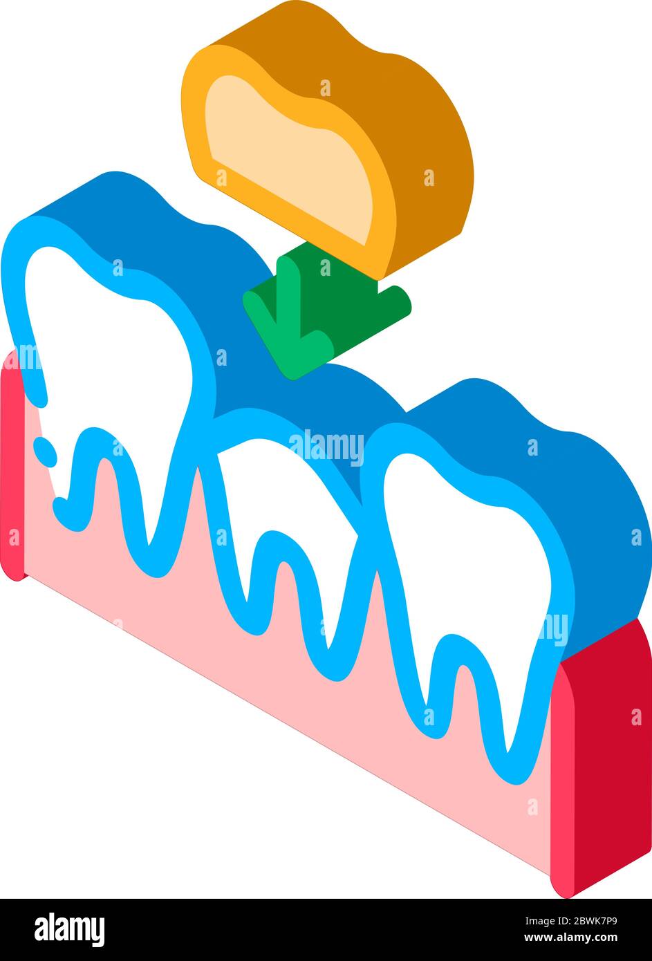 Stomatology Tooth Crown isometric icon vector illustration Stock Vector ...
