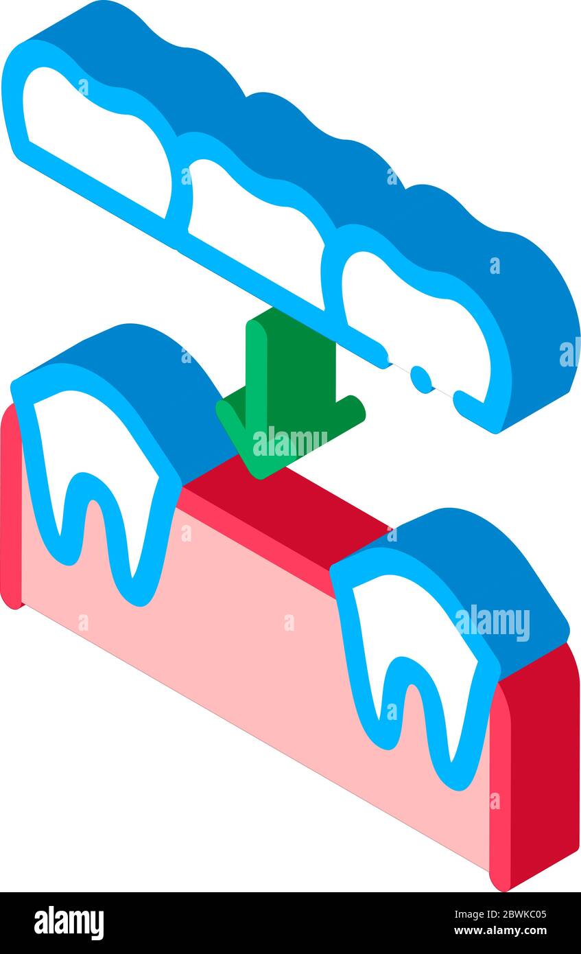 Dental Prosthesis Stomatology isometric icon vector illustration Stock ...