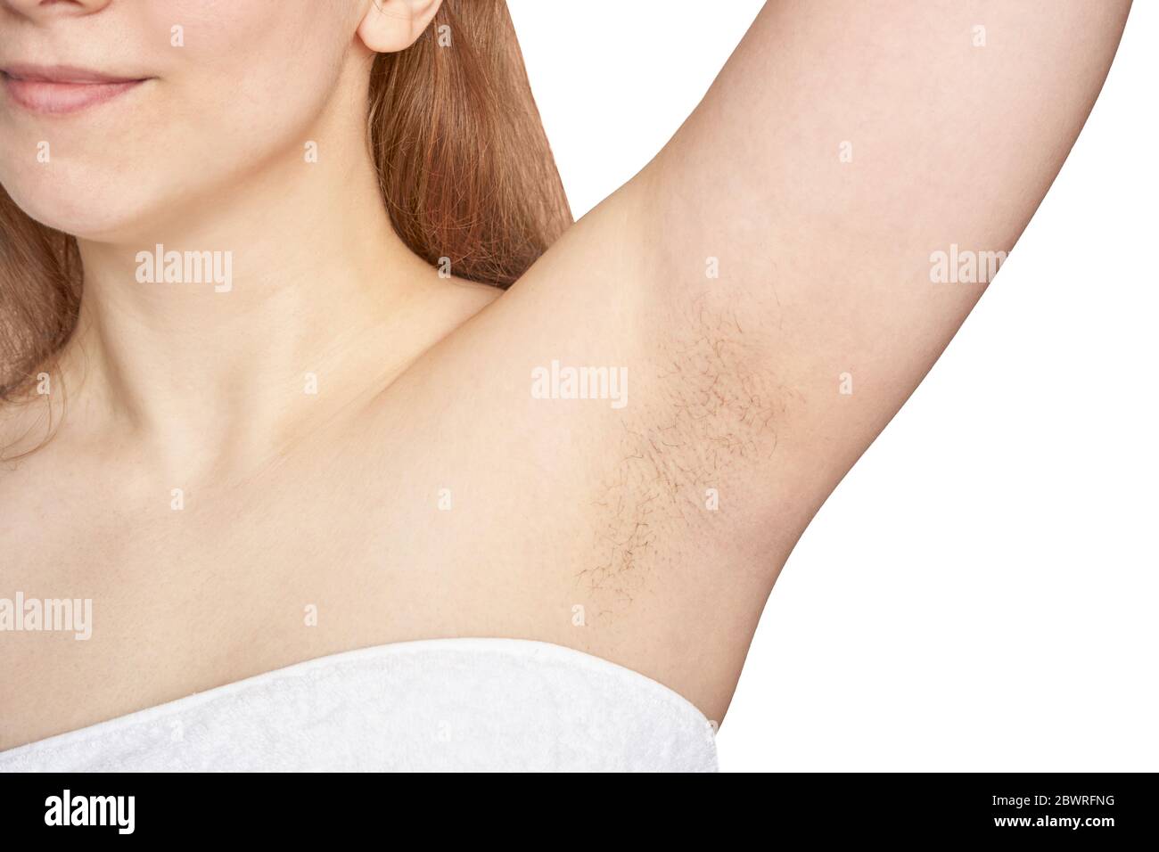 Girl underarm. White woman armpit. Before and after epilation. Stock Photo