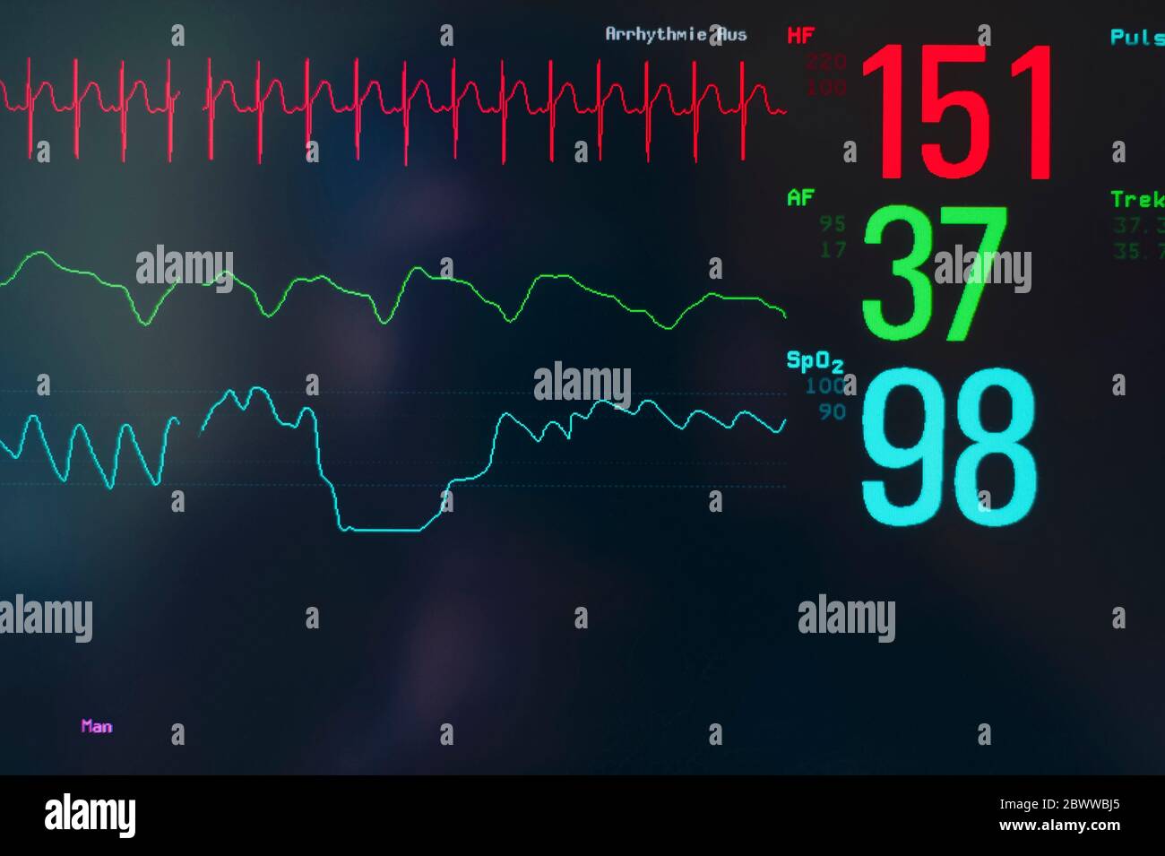 Close-up of EKG screen display Stock Photo