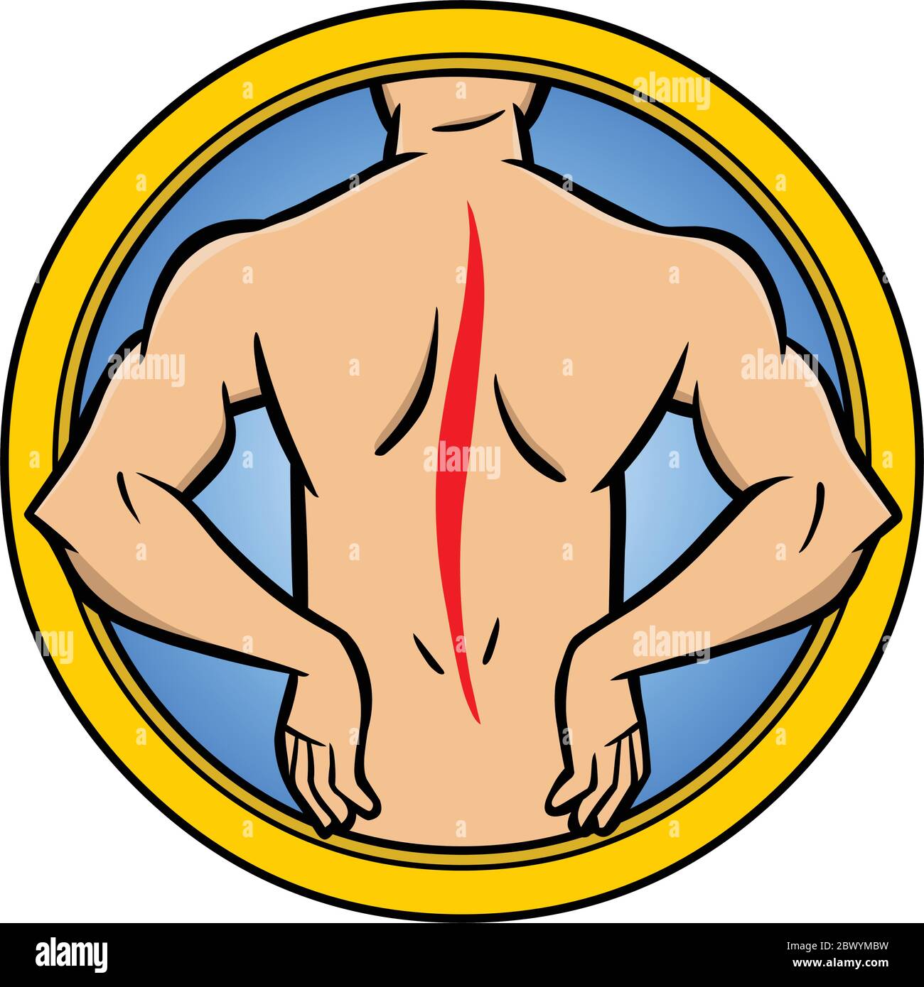 Back Injury- An Illustration of a Back Injury Stock Vector Image & Art ...