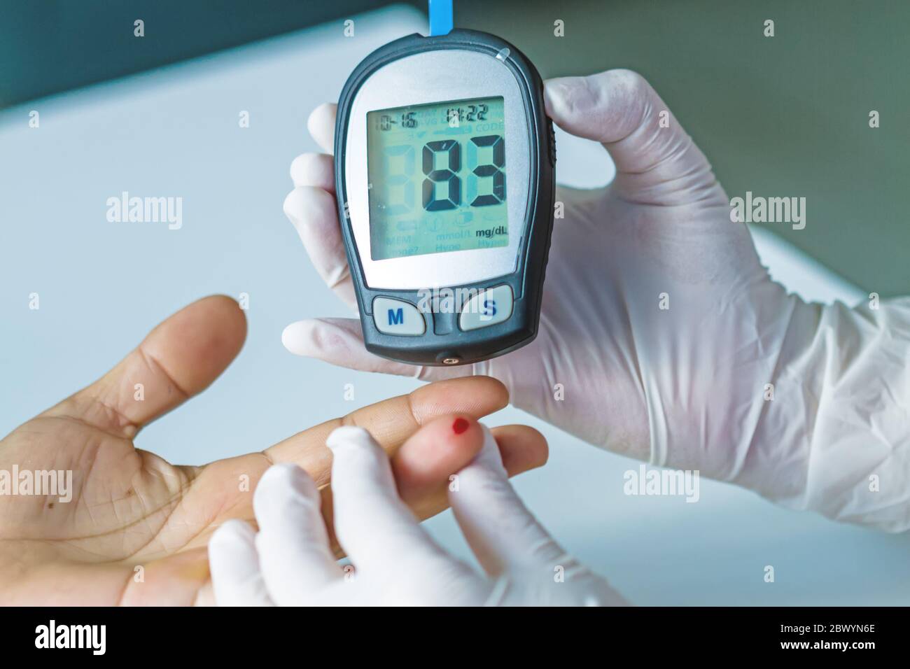 blood glucose meter, the blood sugar value is measured on a finger