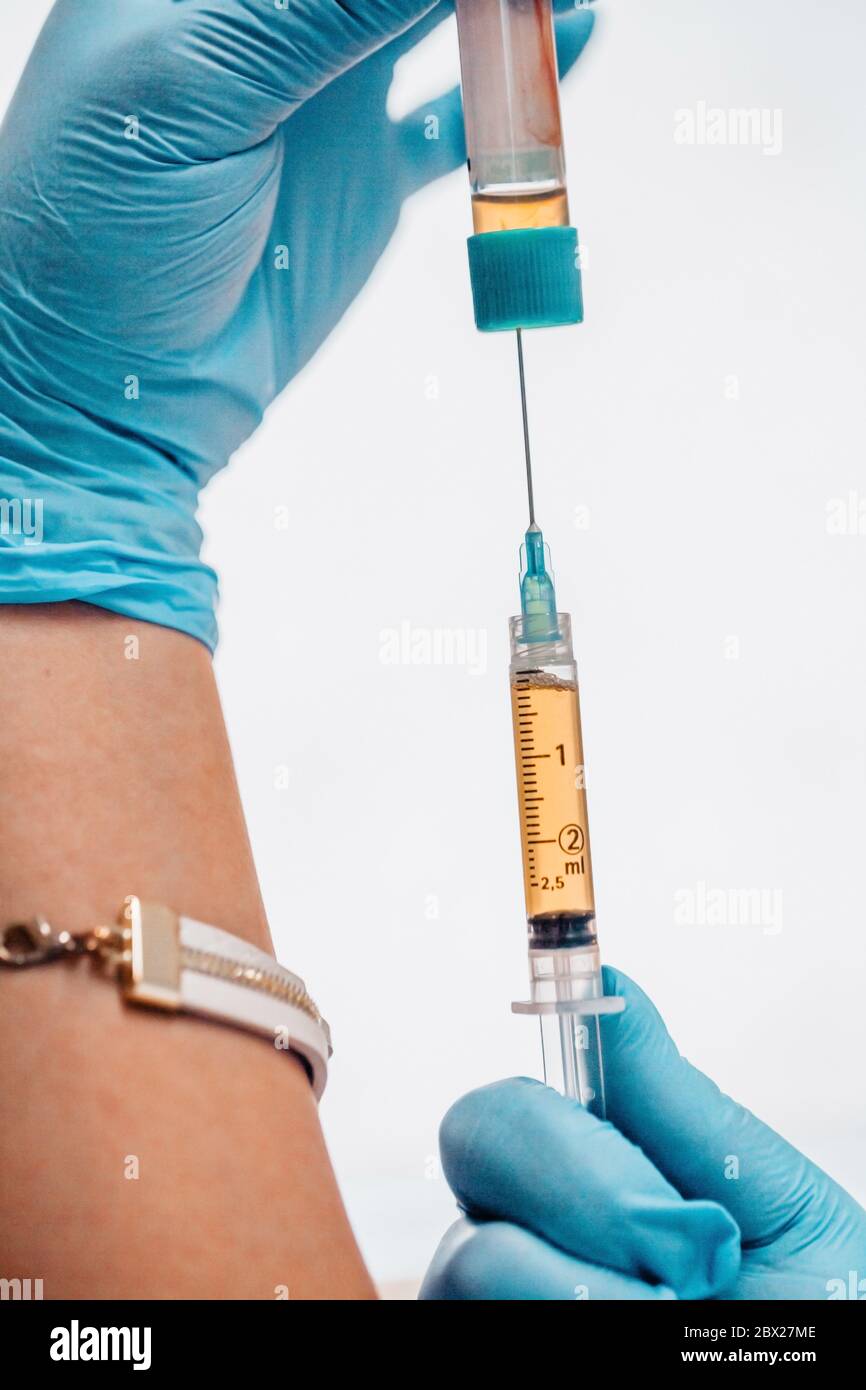 Vertical image format - Plasma lifting - syringe with blood plasma in the hands of a doctor Stock Photo