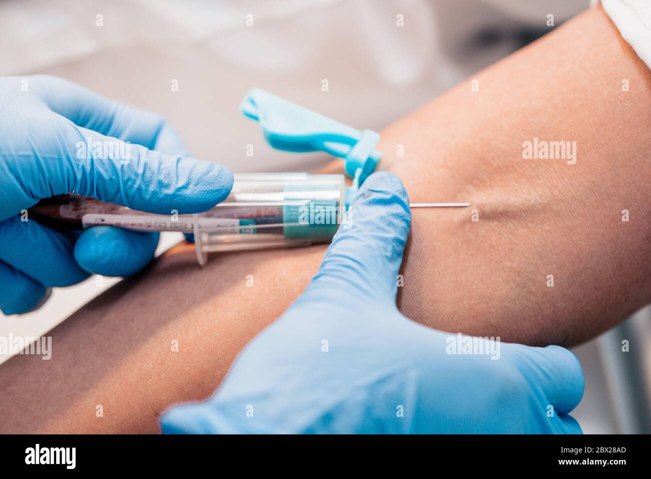 Plasma lifting - blood sampling from a vein to separate plasma in a centrifuge Stock Photo