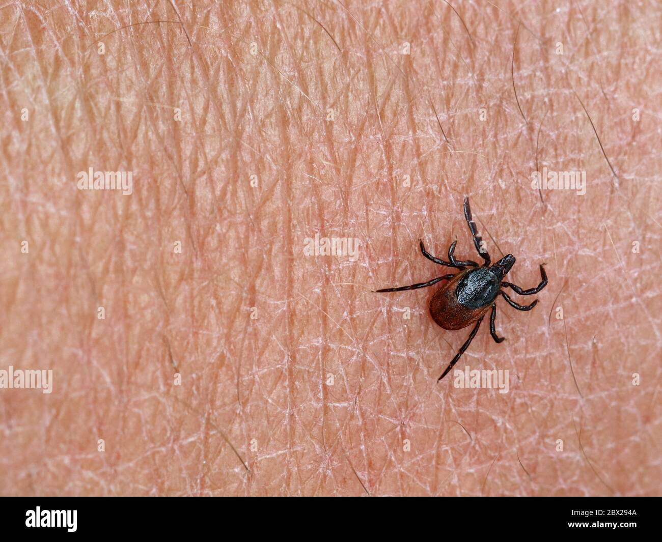 deer tick, ixodes ricinus, on human skin background with copy space Stock Photo