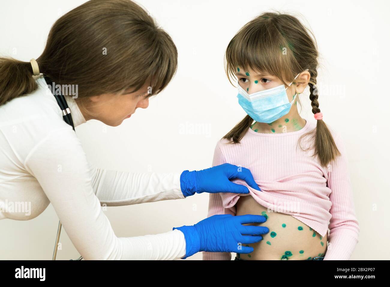 Doctor examining child girl covered with green rashes on face and stomach ill with chickenpox, measles or rubella virus. Stock Photo