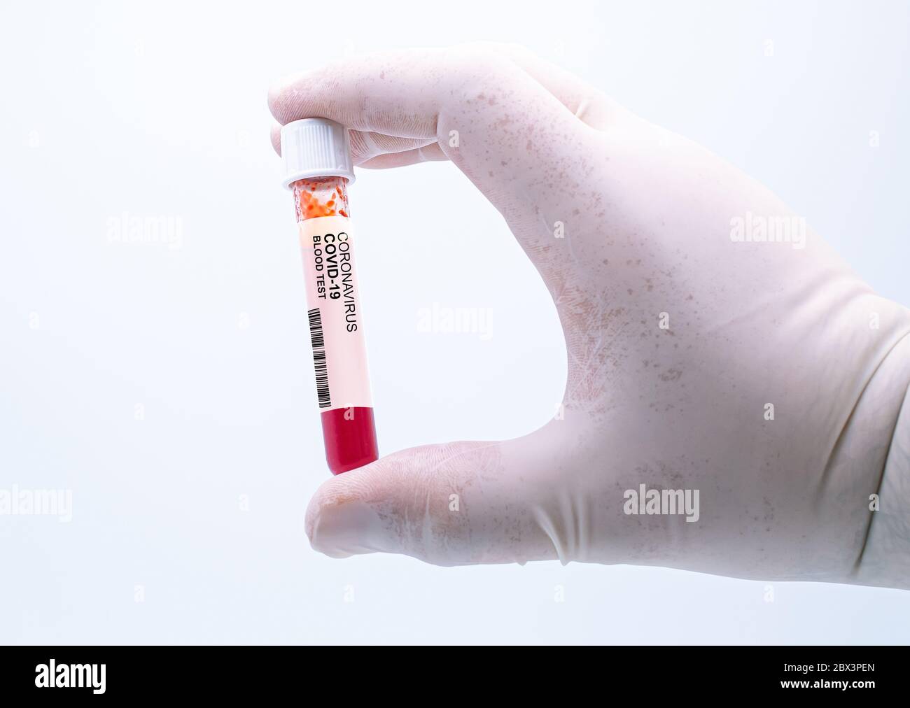 Coronavirus positive blood test. Coronavirus covid-19 outbreaking. Epidemic virus Respiratory Syndrome. Pharmaceutical & genetics Research Centre. Stock Photo