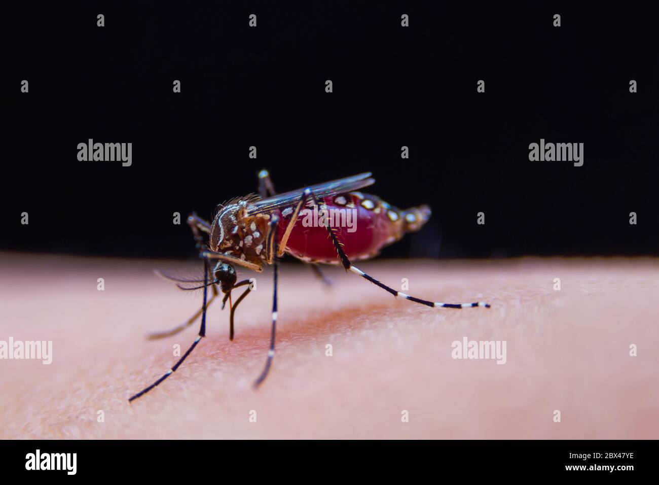 Striped mosquitoes are eating blood on human skin, Dangerous Malaria Infected Mosquito Skin Bite Stock Photo