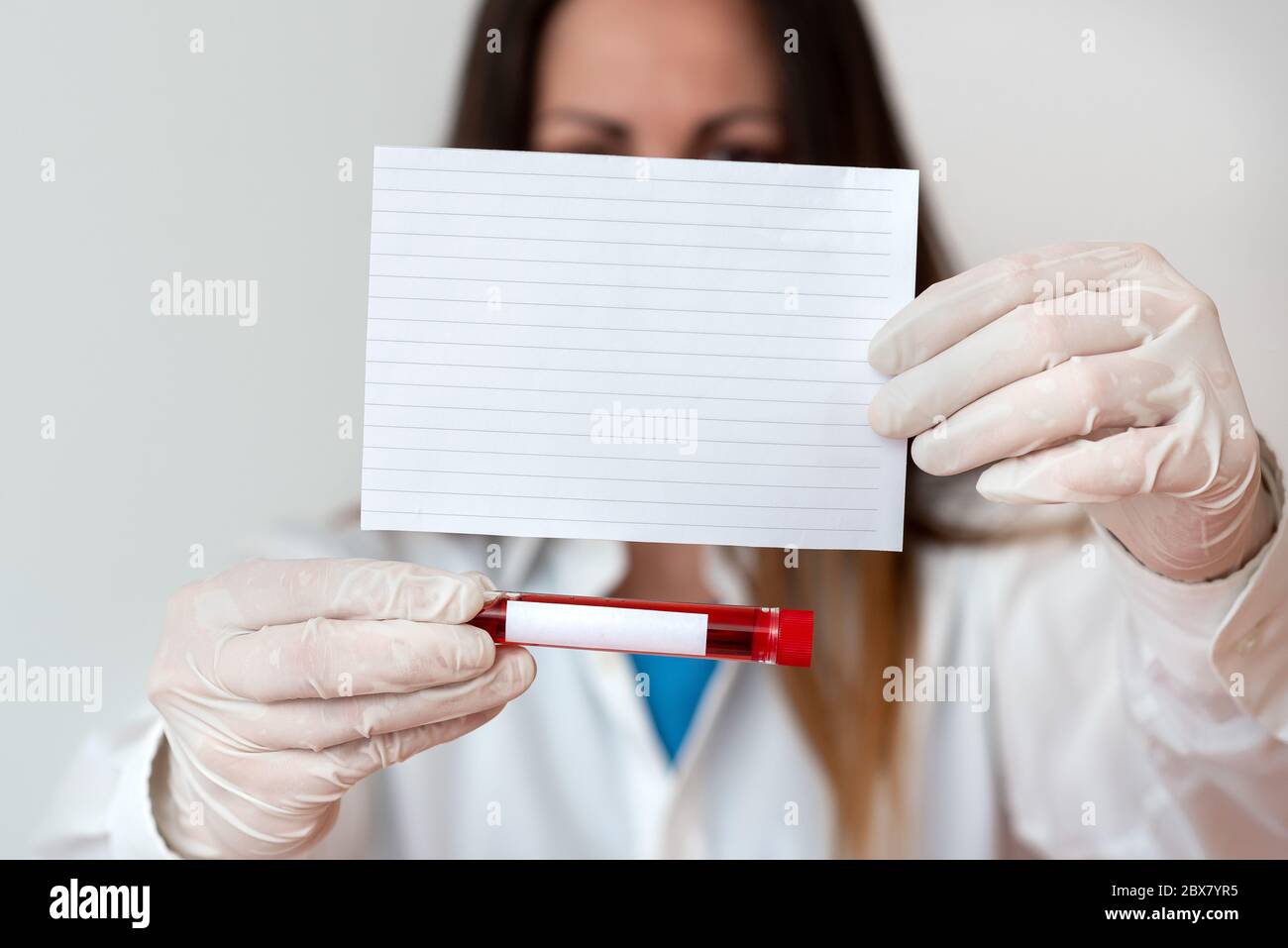 Laboratory Blood Test Sample Shown For Medical Diagnostic Analysis
