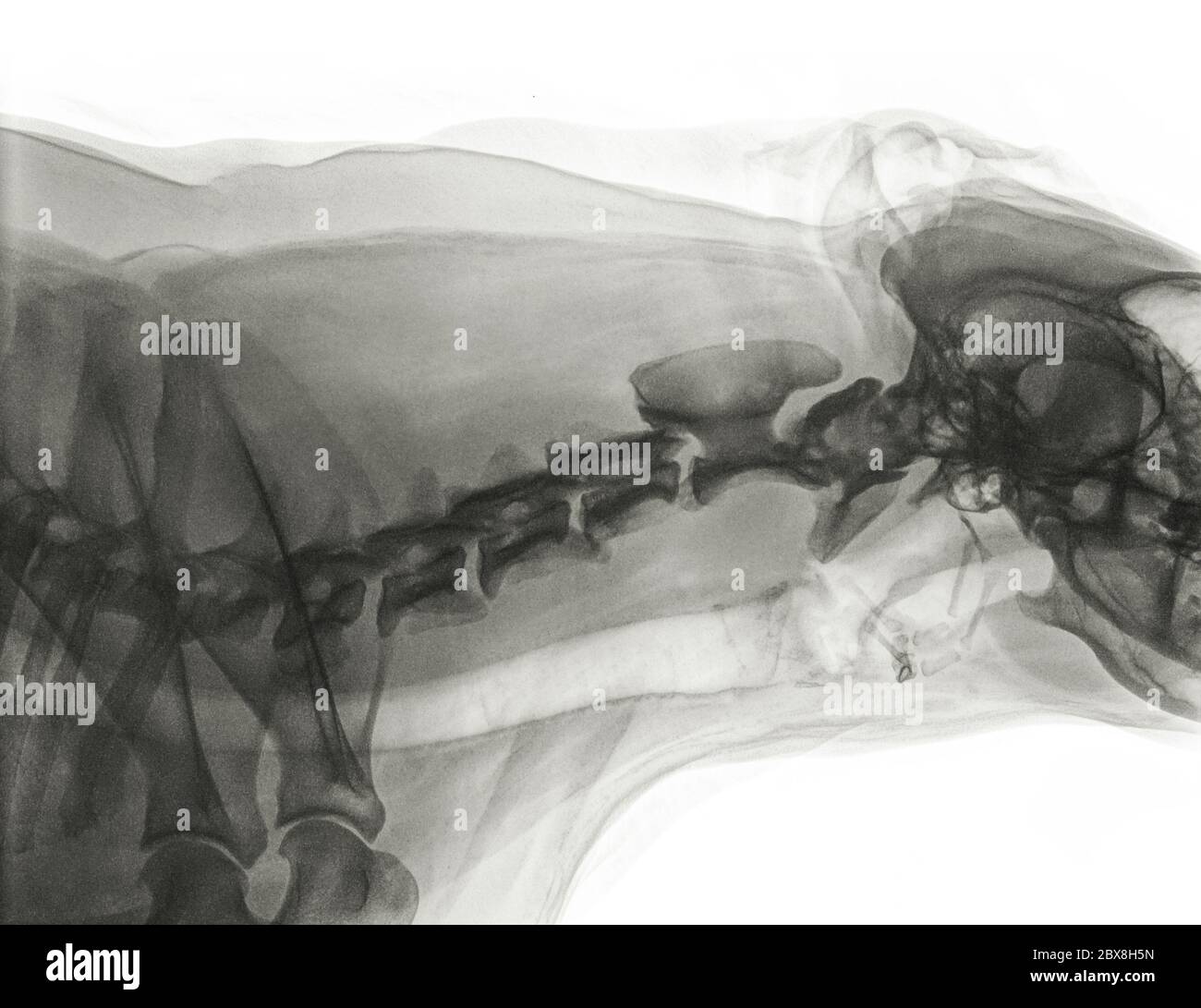 Neck X Ray Of Cervical Vertebrae High Resolution Stock Photography and