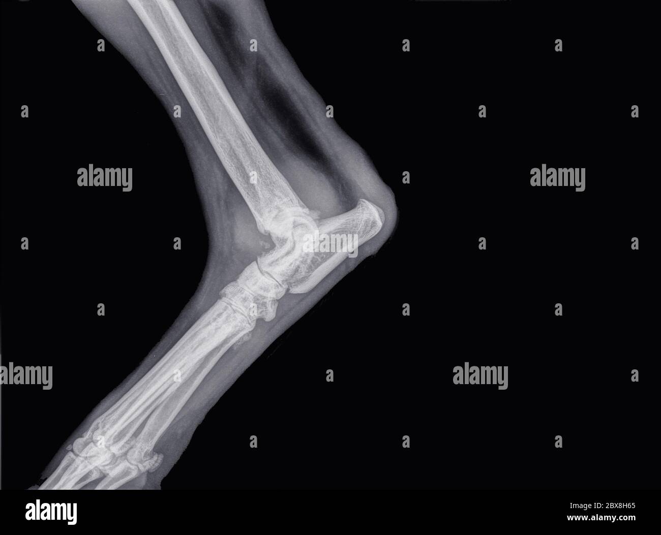 X-ray of osteoarthritis or artrosis in the elbow (ulna, humerus and radius) of a dog Stock Photo