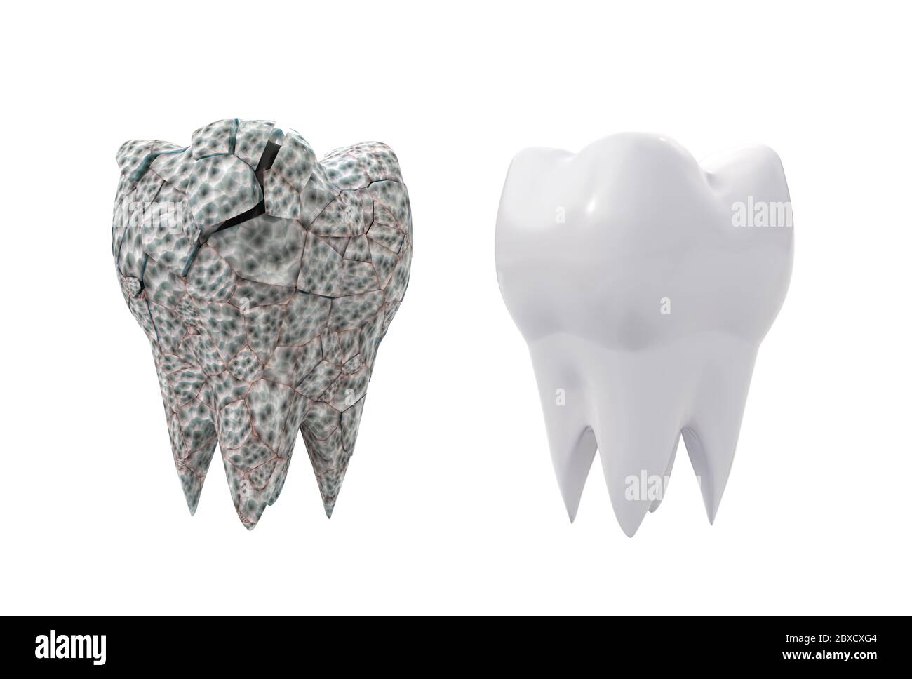 dirty broken molar tooth isolated on white background. 3d illustration ...