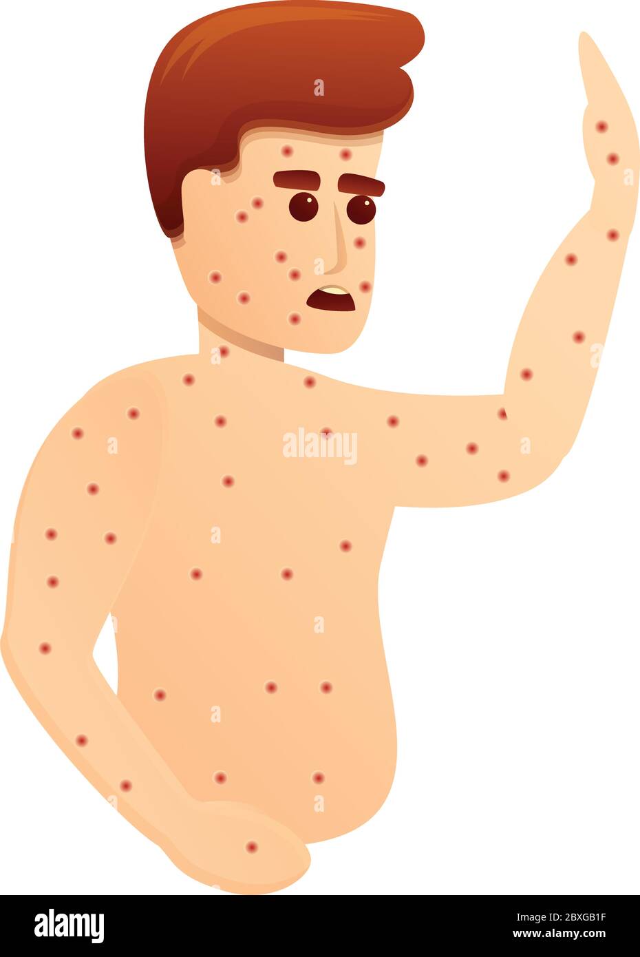 Chicken pox body icon. Cartoon of chicken pox body vector icon for web design isolated on white background Stock Vector