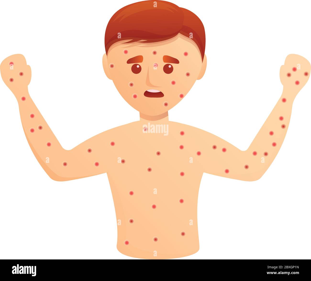 Boy skin rash icon. Cartoon of boy skin rash vector icon for web design  isolated on white background Stock Vector Image & Art - Alamy