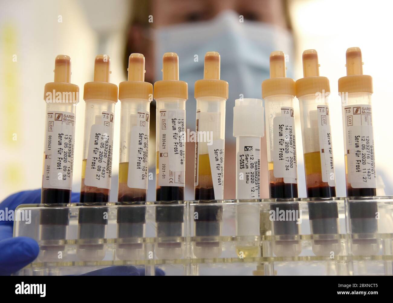 Serum test tubes hires stock photography and images Alamy