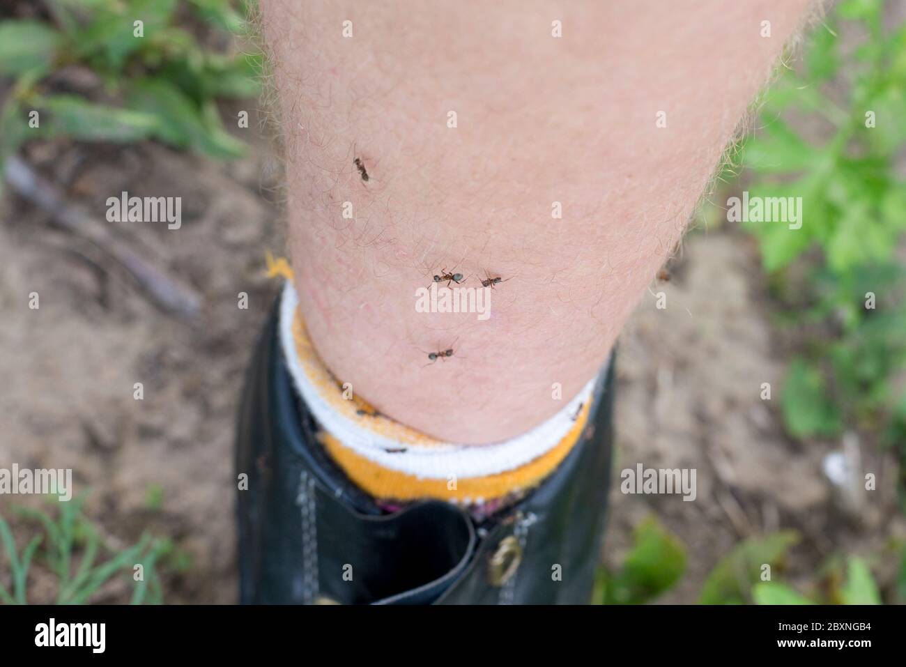 Tiny Ant Bites On Legs Pictures