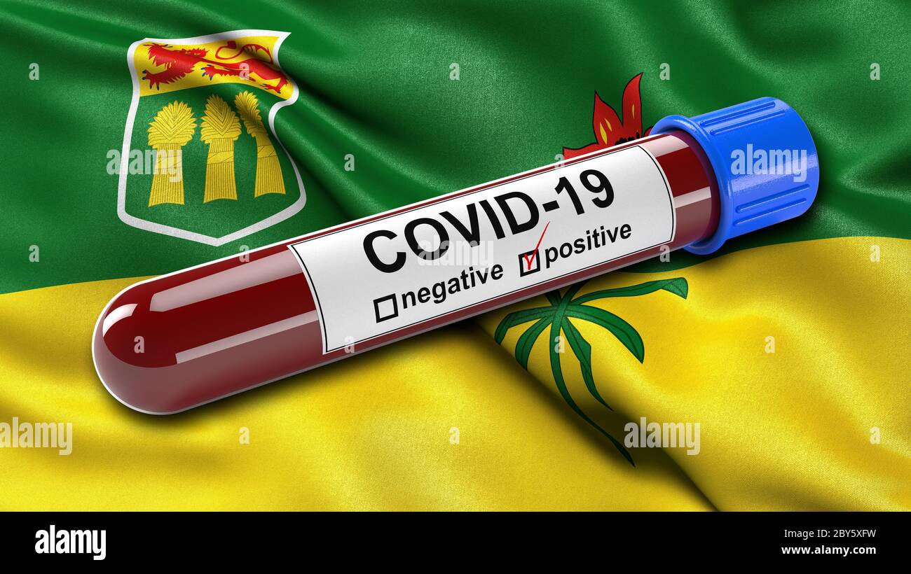 Flag of Saskatchewan waving in the wind with a positive Covid-19 blood test tube. Stock Photo