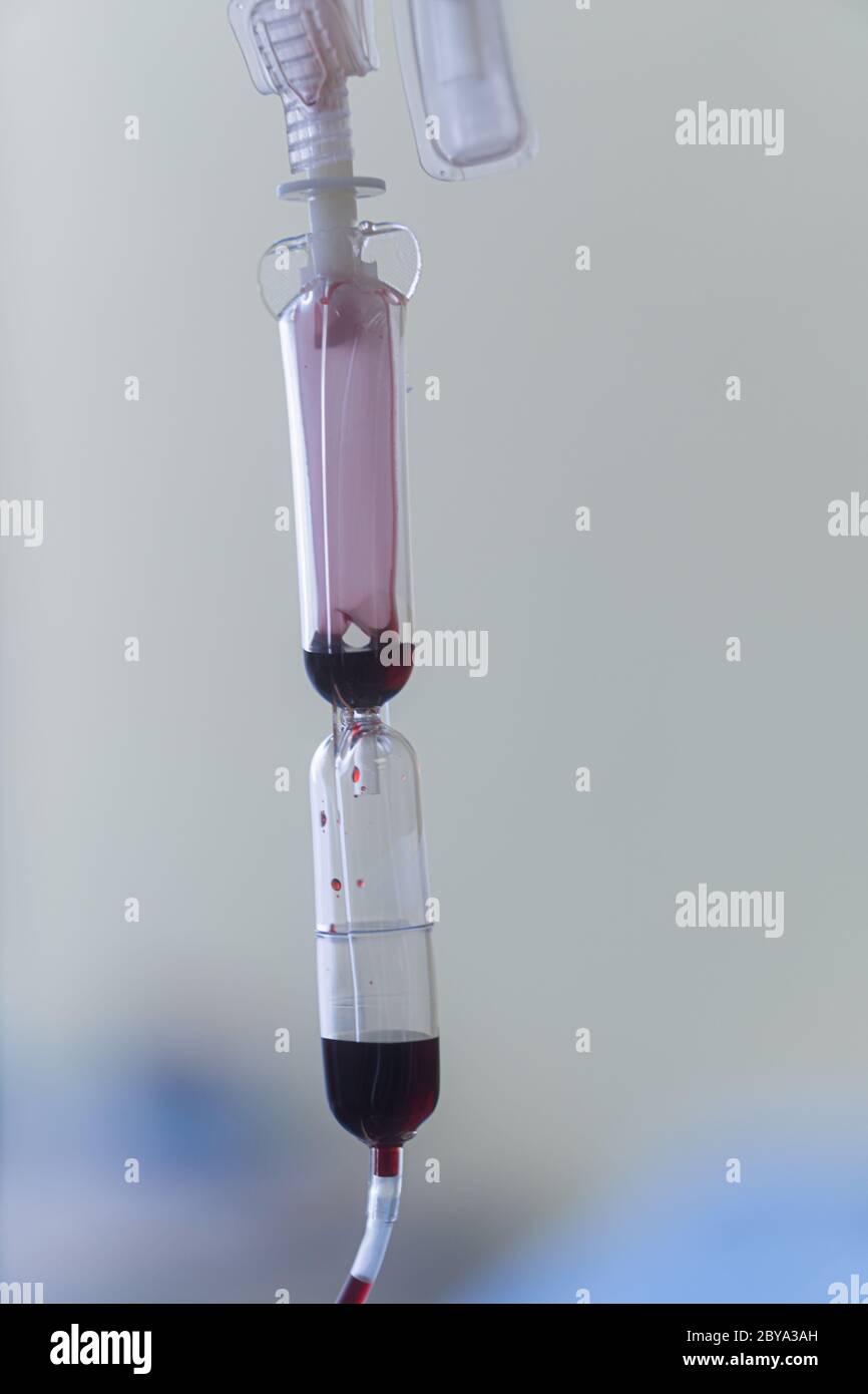 Spare blood bags from laboratory medical hanging on a steel pole at the
