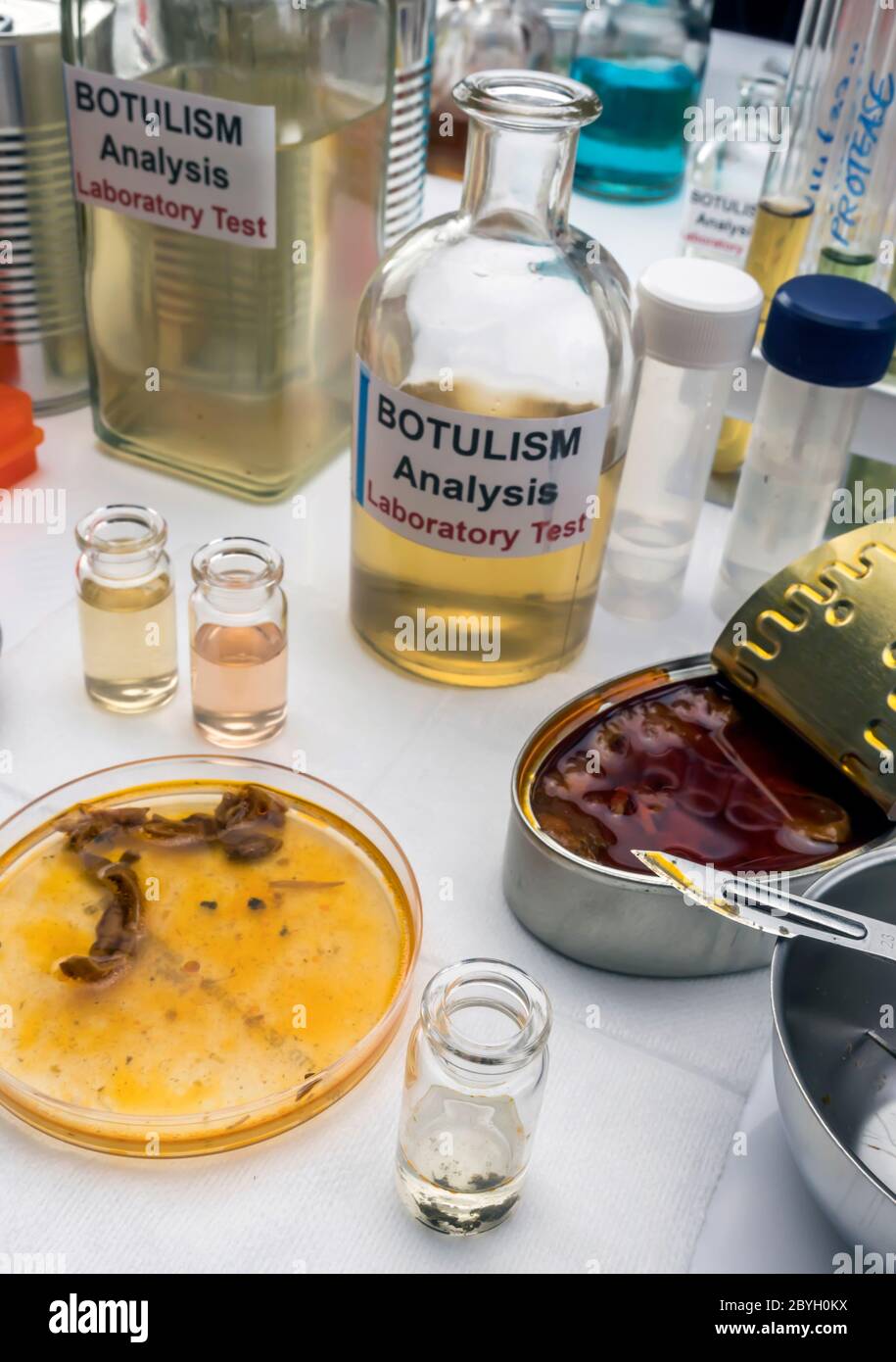 Samples contaminated by Clostridium botulinum toxin that causes botulism in humans, laboratory research, conceptual image Stock Photo