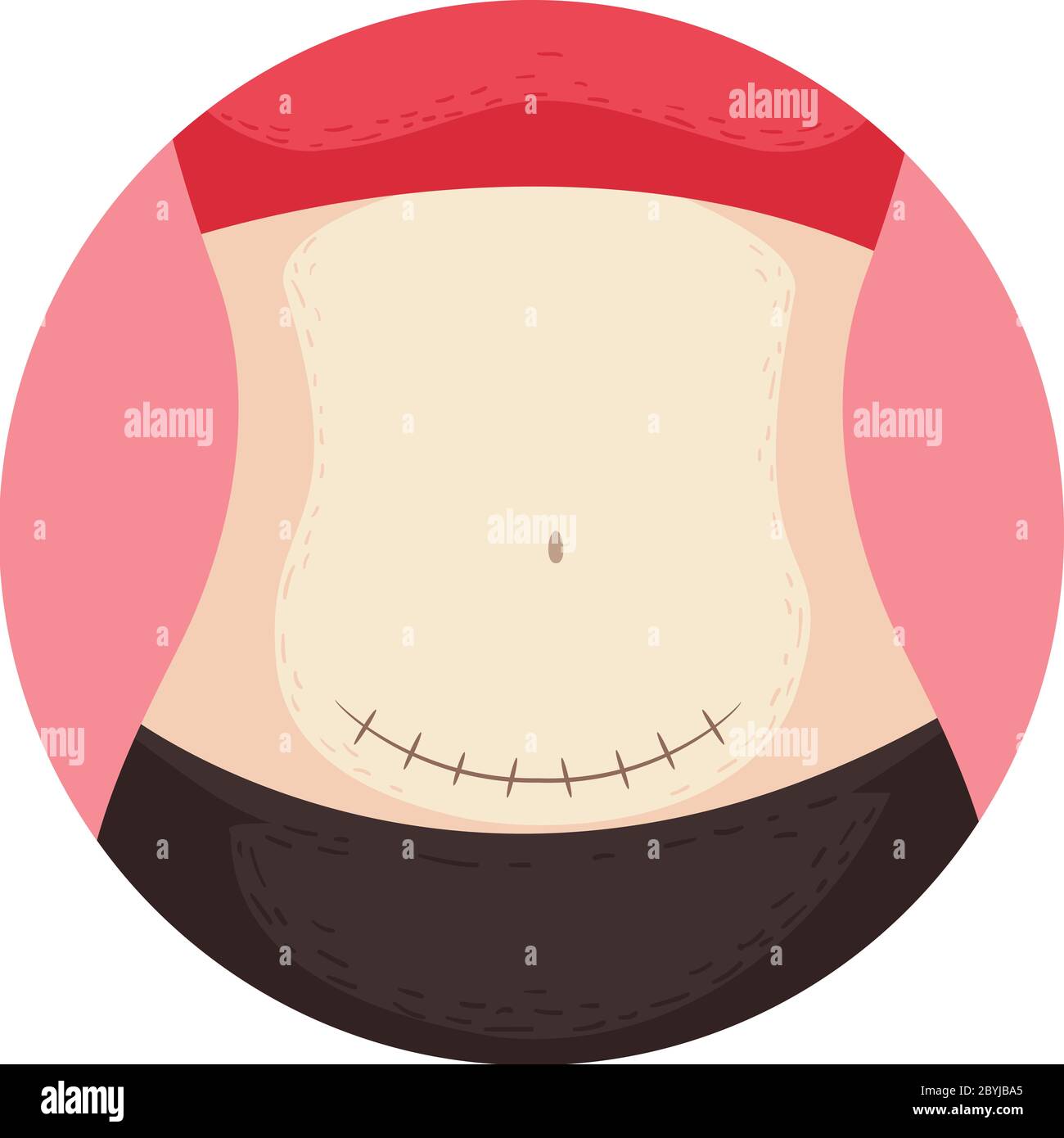 Illustration of a Woman Showing Belly With Stitches From Cesarean