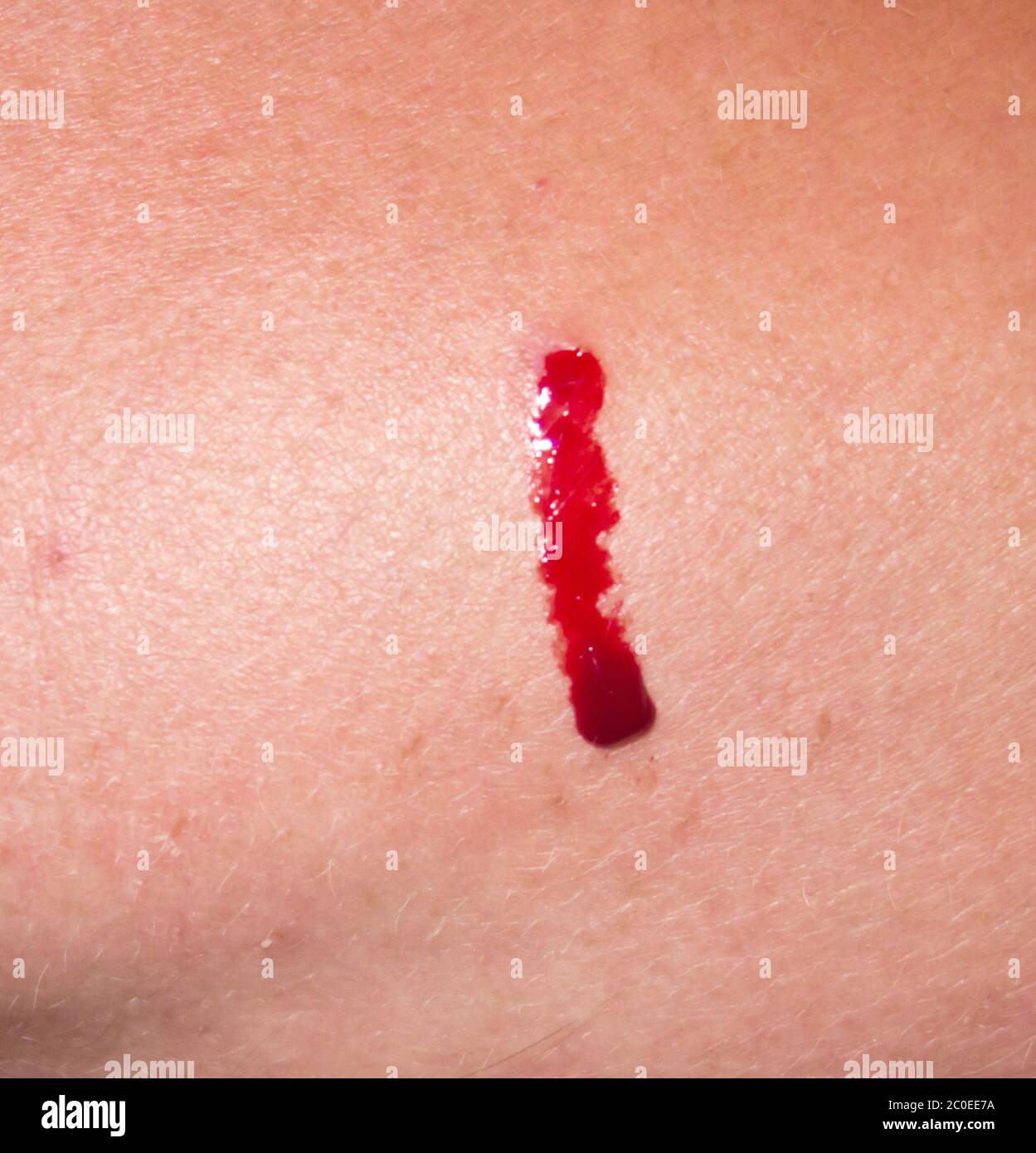 Bleeding cut skin hires stock photography and images Alamy