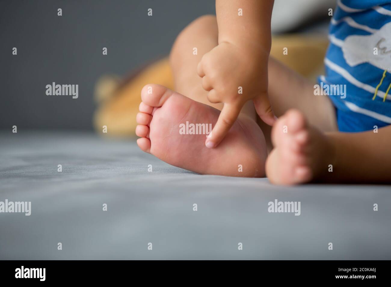 Children feet, sting by a bee, summertime Stock Photo Alamy