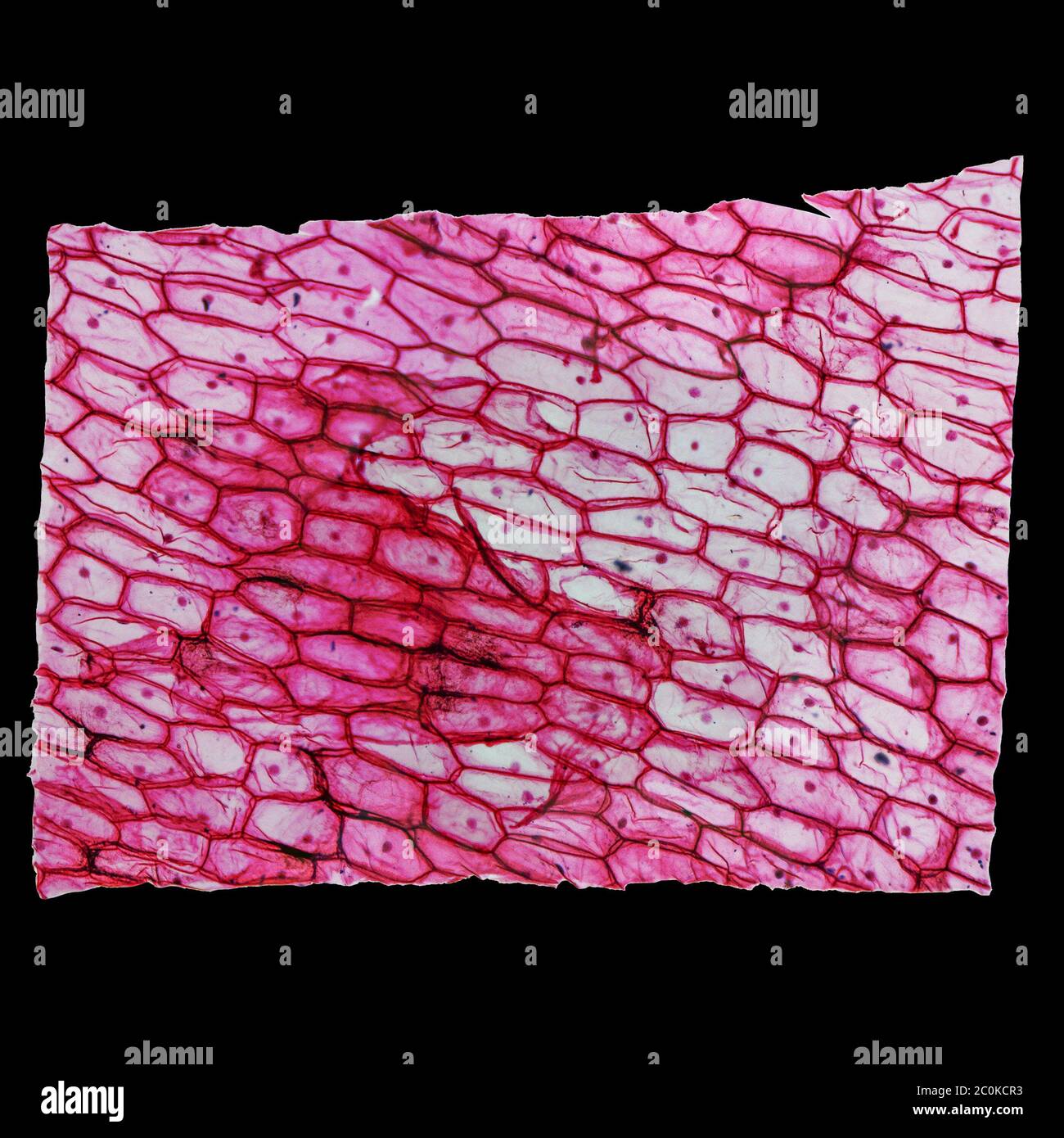 Onion Cells Under Microscope High Power