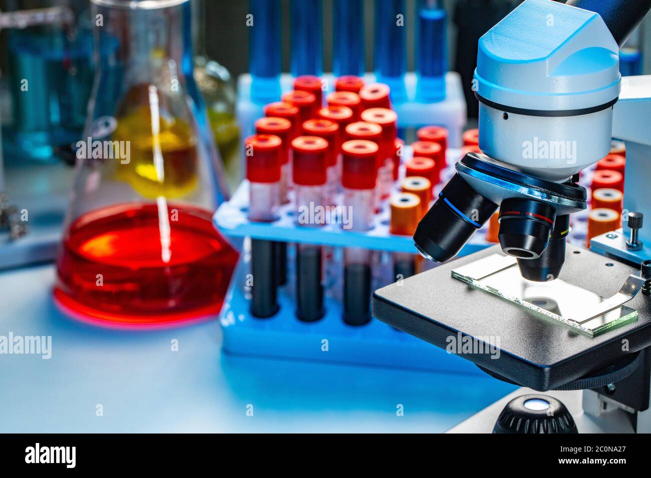 Close up photo of microscope with test tubes with blood samples Stock ...