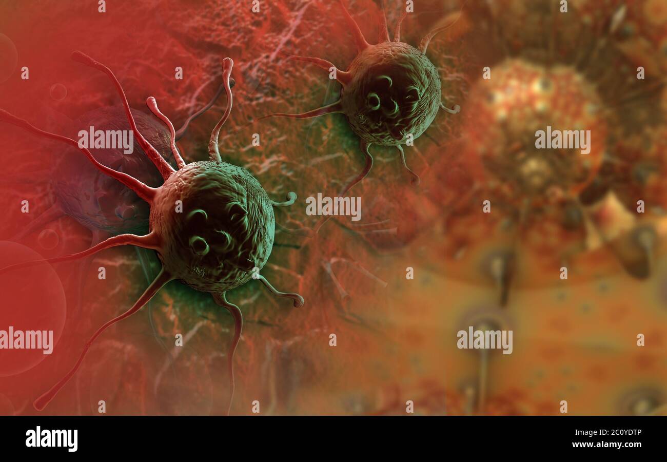 Skin cancer f hi-res stock photography and images - Alamy