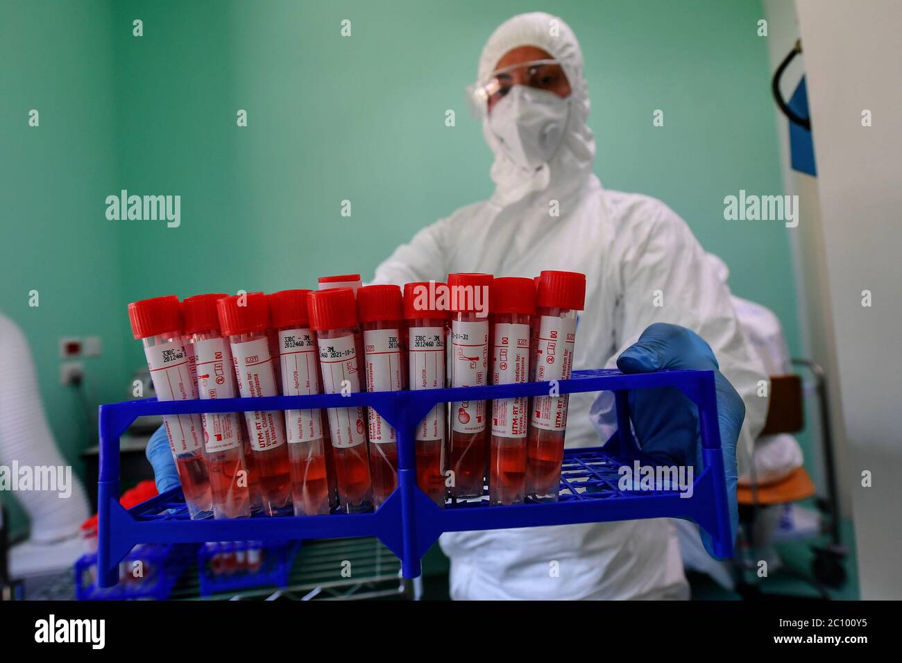 Lab Instrument Rep Covid Testing A medical technician works in the laboratory of the Infectious diseases ...