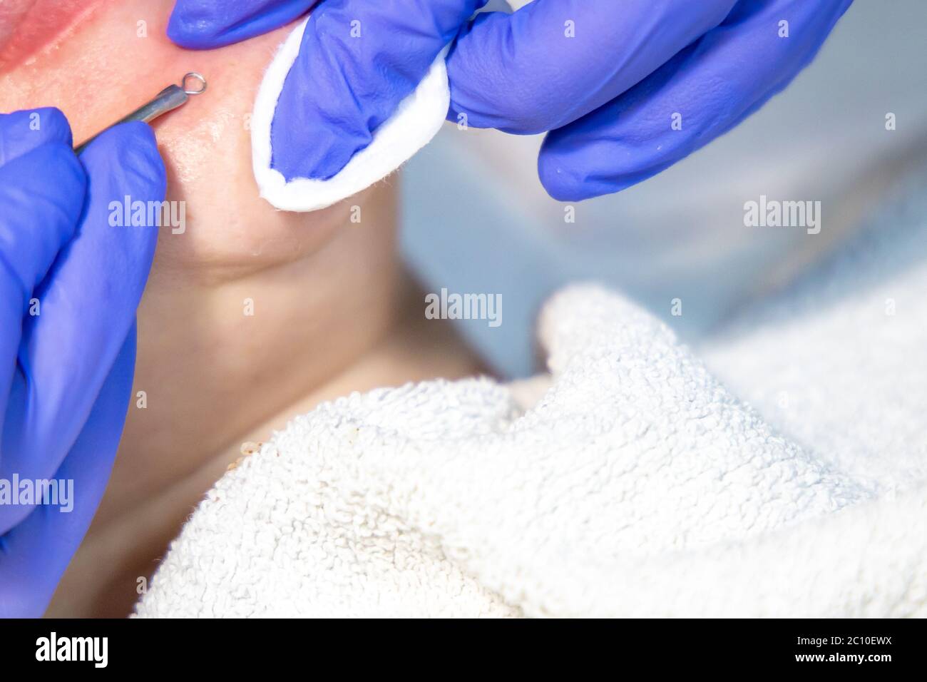 Cleaning procedure hi-res stock photography and images - Alamy
