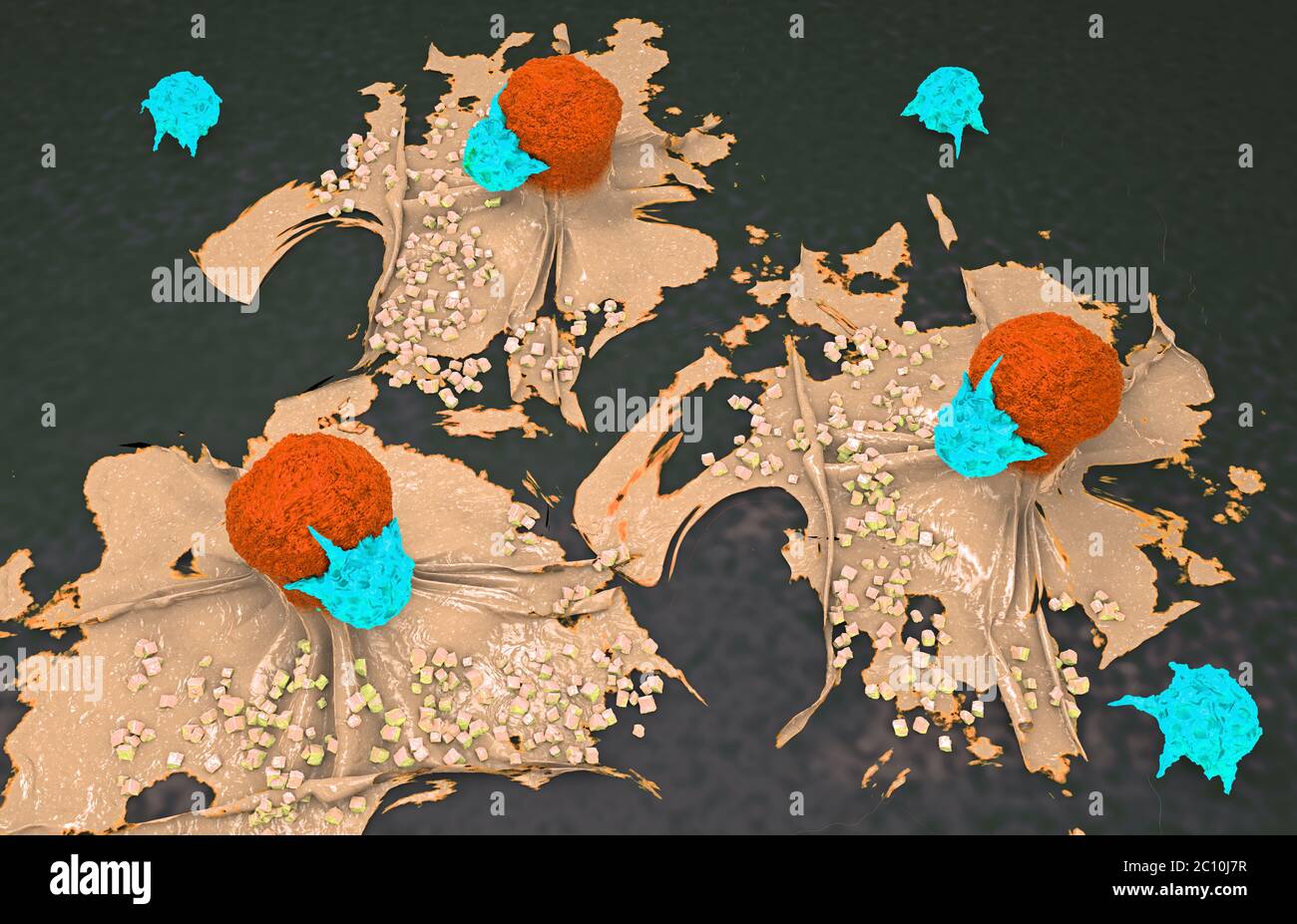 3d illustration of a cancer cell attacked and killed by lymphocytes ...