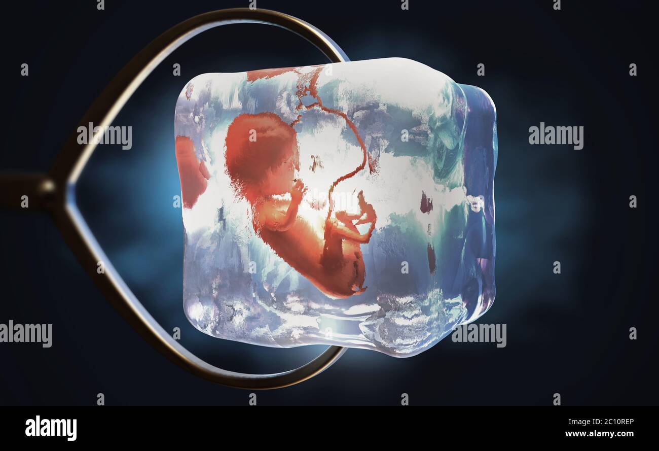 3d illustration of a cryopreserved fetus frozen into ice cube held by metal pliers Stock Photo