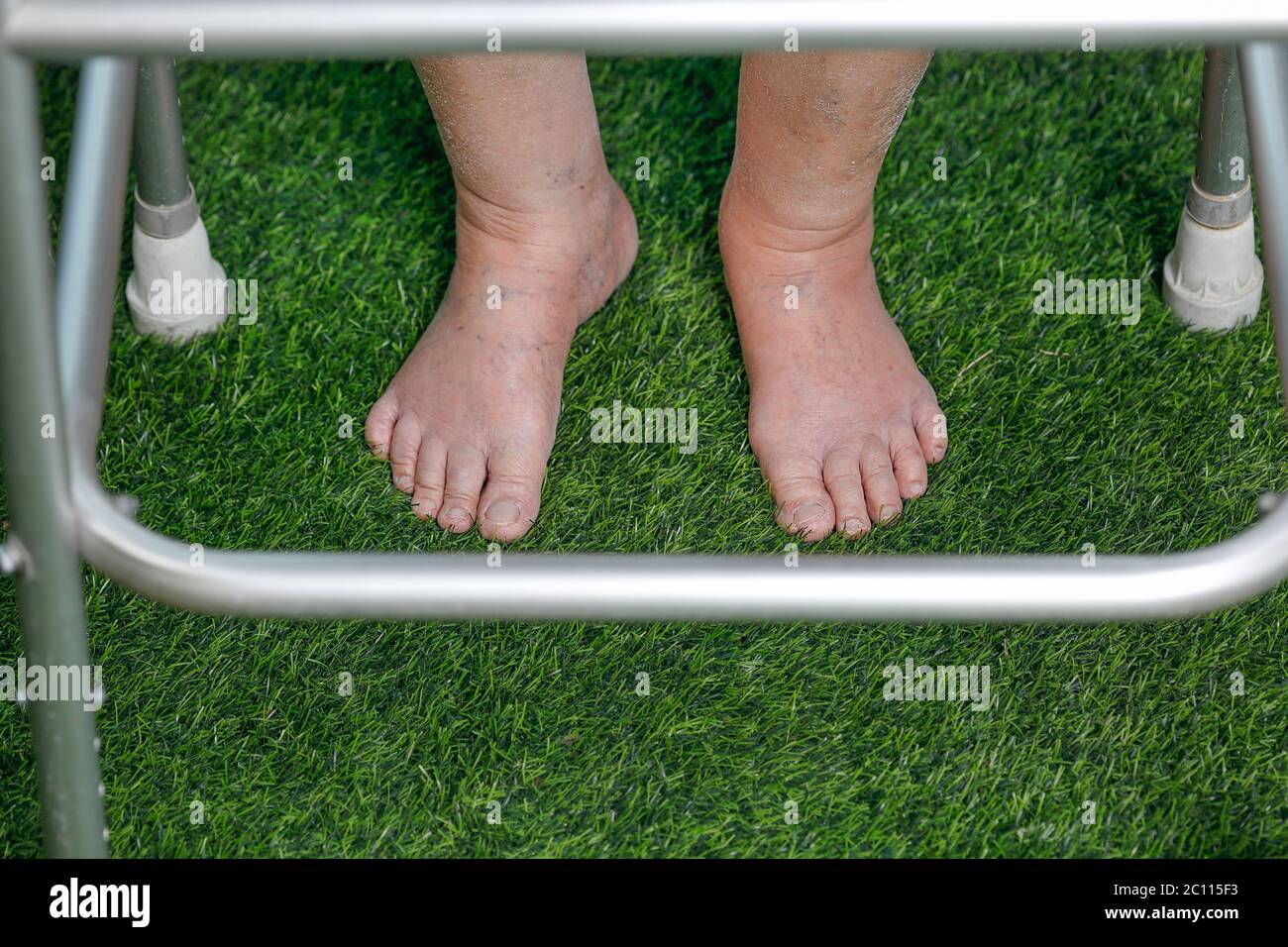 Elderly woman bare swollen feet on grass with walker Stock Photo Alamy
