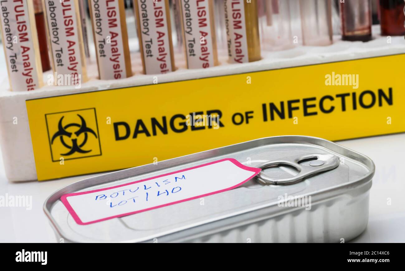 Canned food can contaminated by Clostridium botulinum toxin that causes botulism in humans
