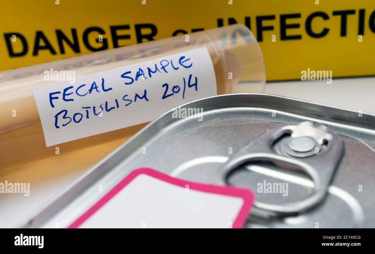 Canned food can contaminated by Clostridium botulinum toxin that causes botulism in humans