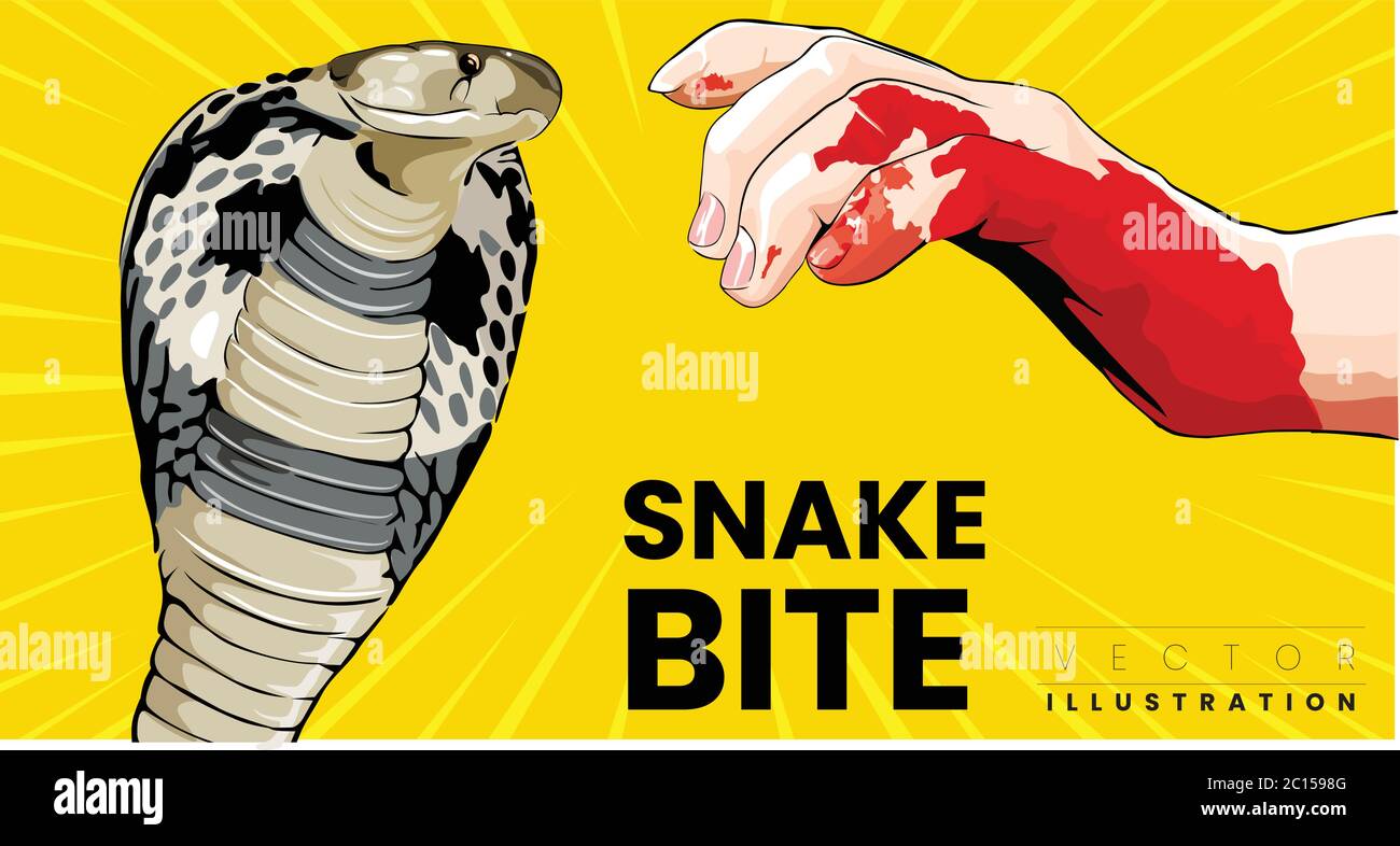 Snake bite on arm Cobra snake bite man hand need first Aid and dangerous Stock Vector