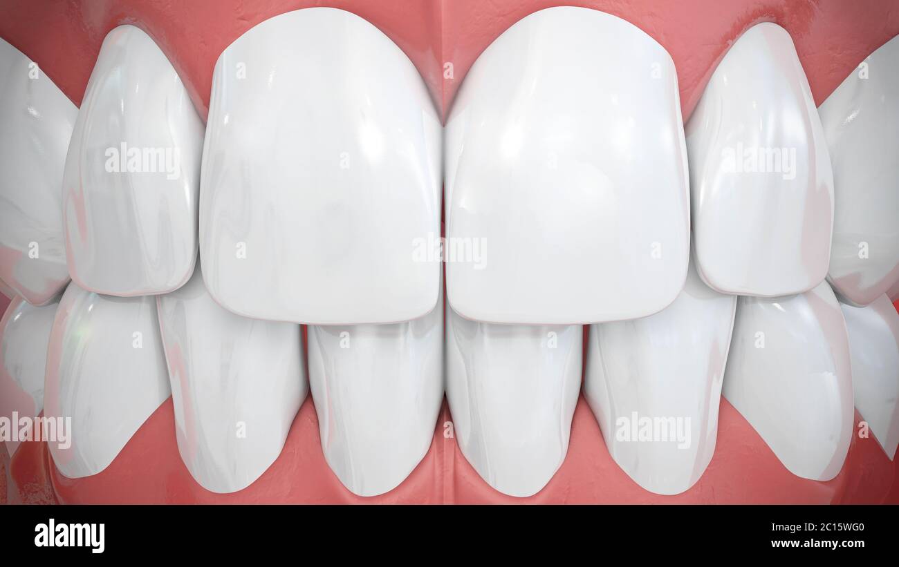 Frontal View On Sparkling White Anterior Teeth Stock Photo Alamy
