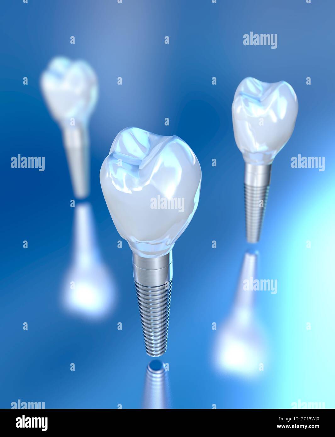 3d illustration of three tooth implants Stock Photo