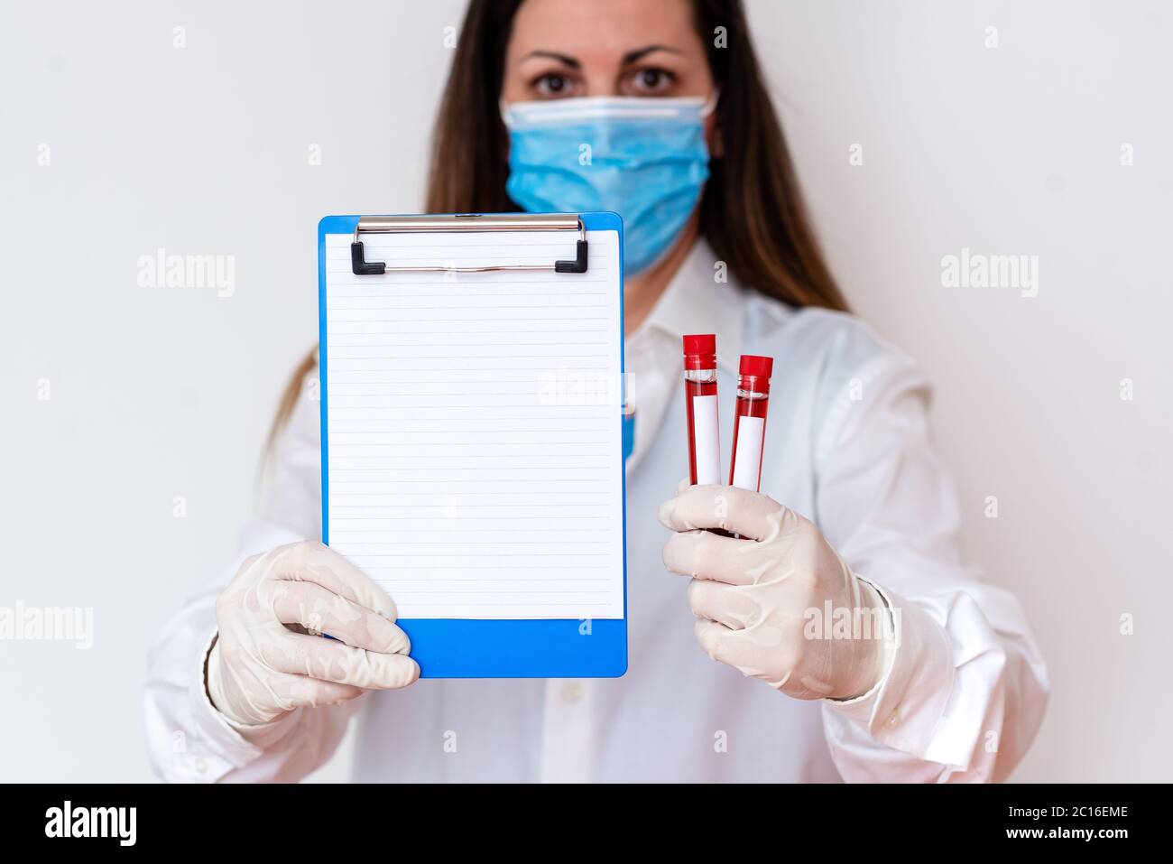 Laboratory Blood Test Sample Shown For Medical Diagnostic Analysis