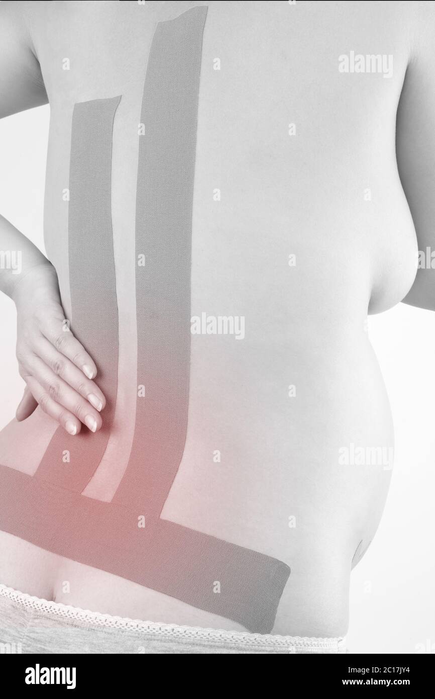 Therapeutic taping. Back pain. Stock Photo