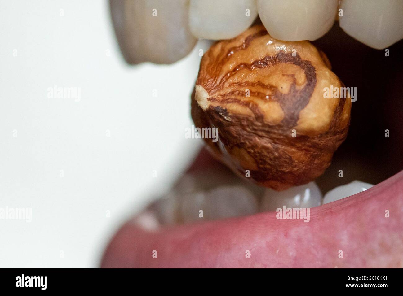 Hazelnut Rash Nuremberg, Germany. 14th June, 2020. ILLUSTRATION - A woman holds a ...
