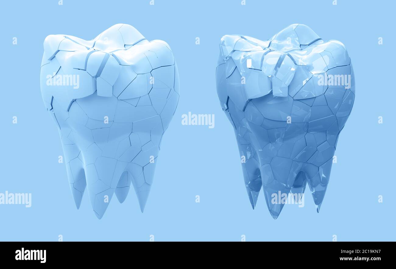Broken molars tooth and whole tooth isolated on blue background. 3d