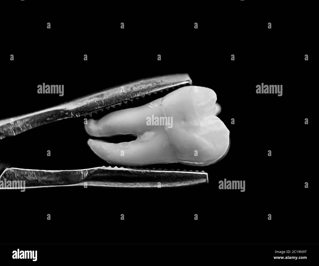 bad real tooth removed in the dental forceps on black background Stock Photo