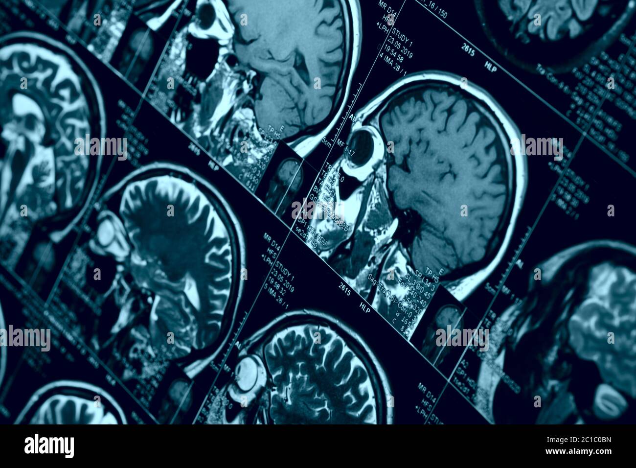 MRI scan of human brain, toned image Stock Photo