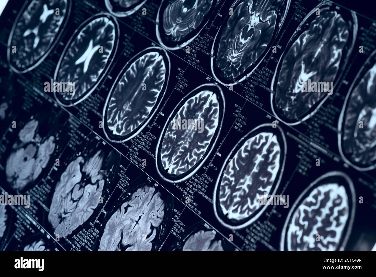 MRI scan of human brain, toned image Stock Photo - Alamy