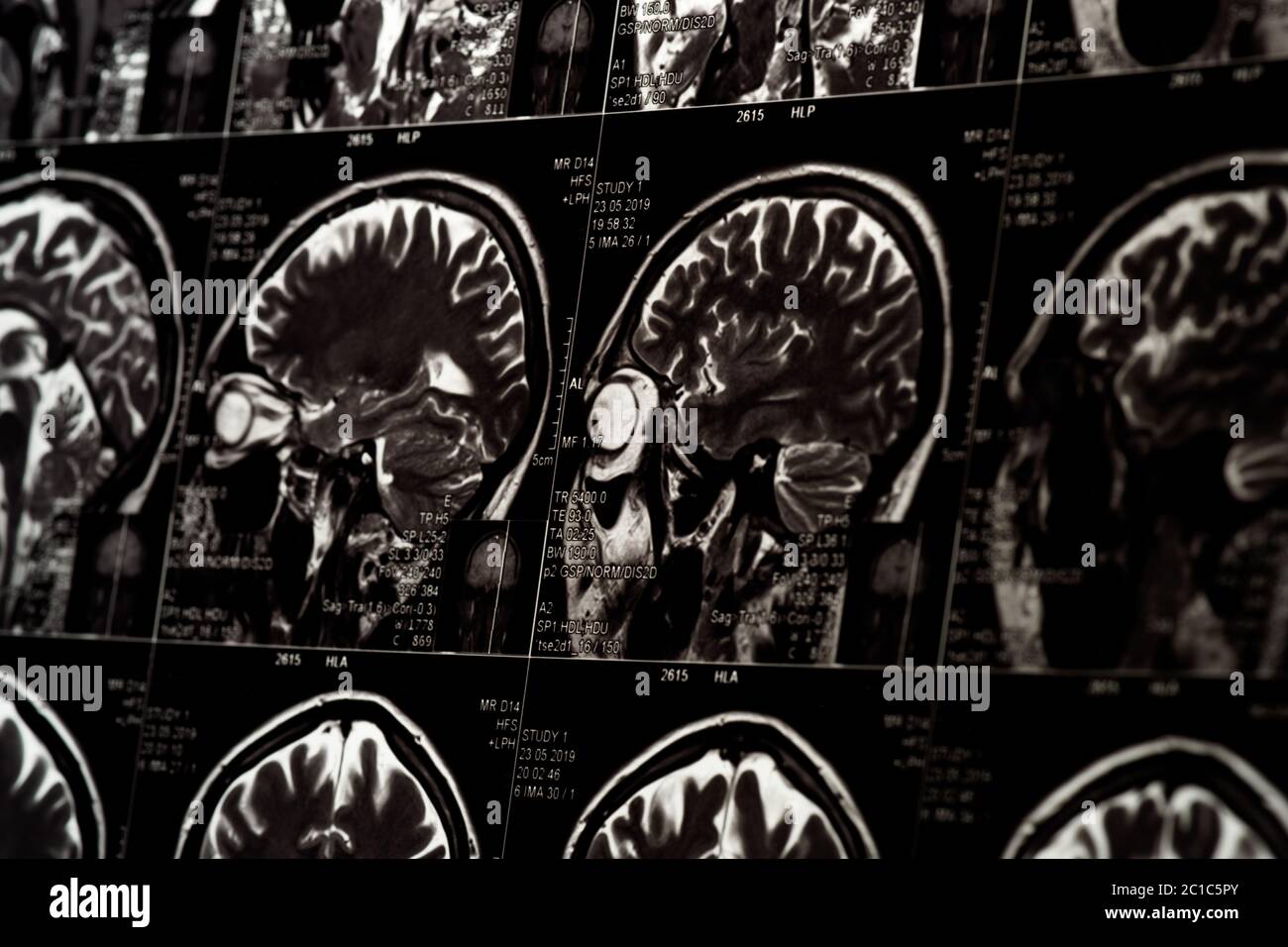 MRI scan of human brain, monochrome Stock Photo